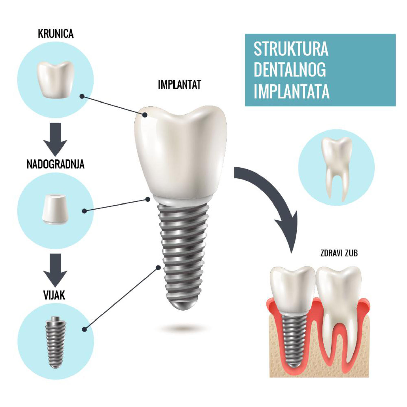 https://ars-dentalis.com/wp-content/uploads/2020/11/implantati-1.jpg